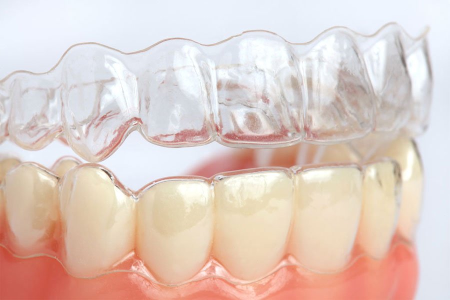 does insurance cover invisalign clear braces in nyc