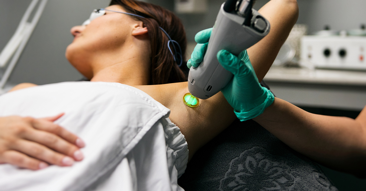 Does Laser Hair Removal Hurt? Tolerating the Procedure